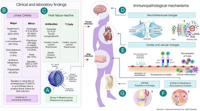 In Search of the Holy Grail: A Specific Diagnostic Test for Rheumatic Fever